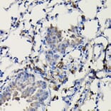 Immunohistochemistry - Anti-COTL1 Antibody (A14581) - Antibodies.com