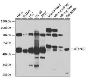 Western Blot - Anti-SCA10 Antibody (A14582) - Antibodies.com