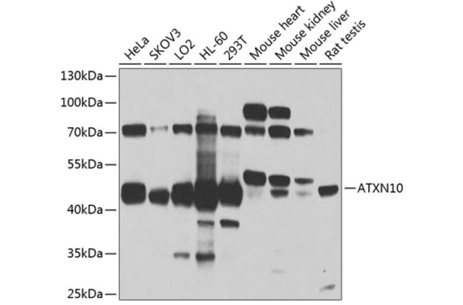 Western Blot - Anti-SCA10 Antibody (A14582) - Antibodies.com