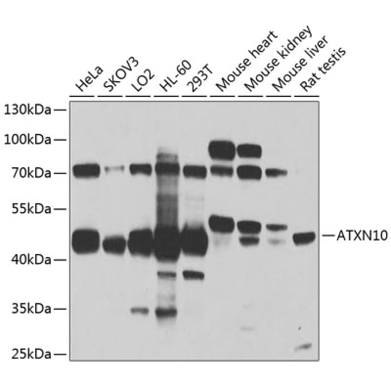 Western Blot - Anti-SCA10 Antibody (A14582) - Antibodies.com