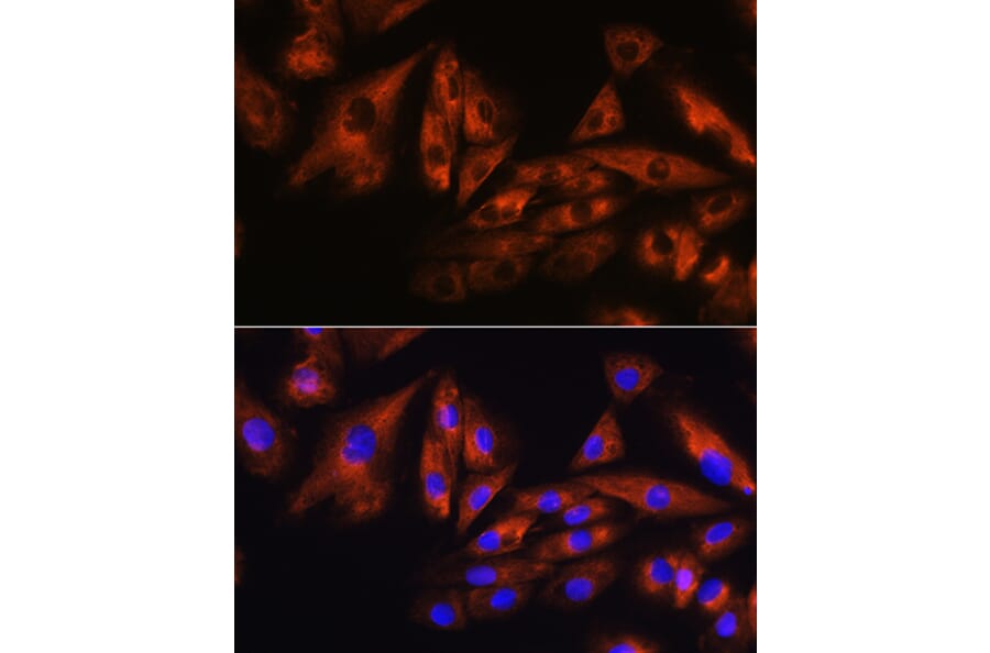 Immunofluorescence - Anti-SCA10 Antibody (A14582) - Antibodies.com