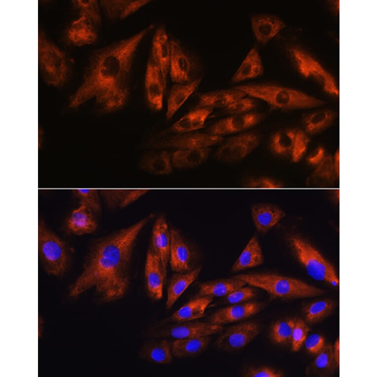 Immunofluorescence - Anti-SCA10 Antibody (A14582) - Antibodies.com