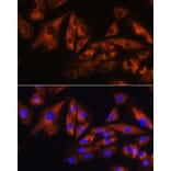 Immunofluorescence - Anti-SCA10 Antibody (A14582) - Antibodies.com