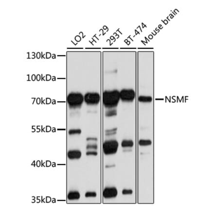 Western Blot - Anti-NELF Antibody (A14583) - Antibodies.com