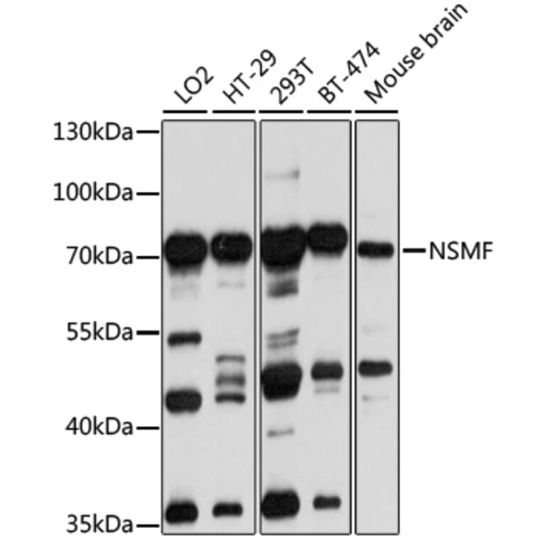 Western Blot - Anti-NELF Antibody (A14583) - Antibodies.com