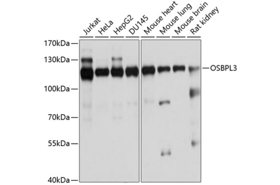Western Blot - Anti-ORP-3 Antibody (A14584) - Antibodies.com