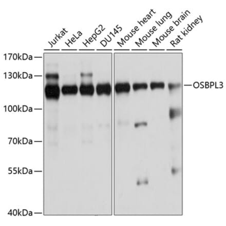 Western Blot - Anti-ORP-3 Antibody (A14584) - Antibodies.com