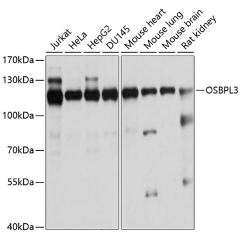 Western Blot - Anti-ORP-3 Antibody (A14584) - Antibodies.com
