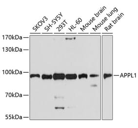 Western Blot - Anti-APPL Antibody (A14585) - Antibodies.com