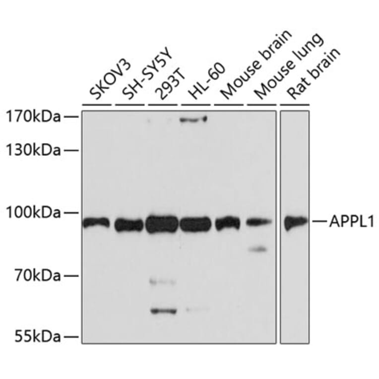 Western Blot - Anti-APPL Antibody (A14585) - Antibodies.com