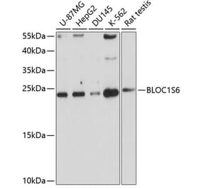Western Blot - Anti-Pallidin Antibody (A14586) - Antibodies.com