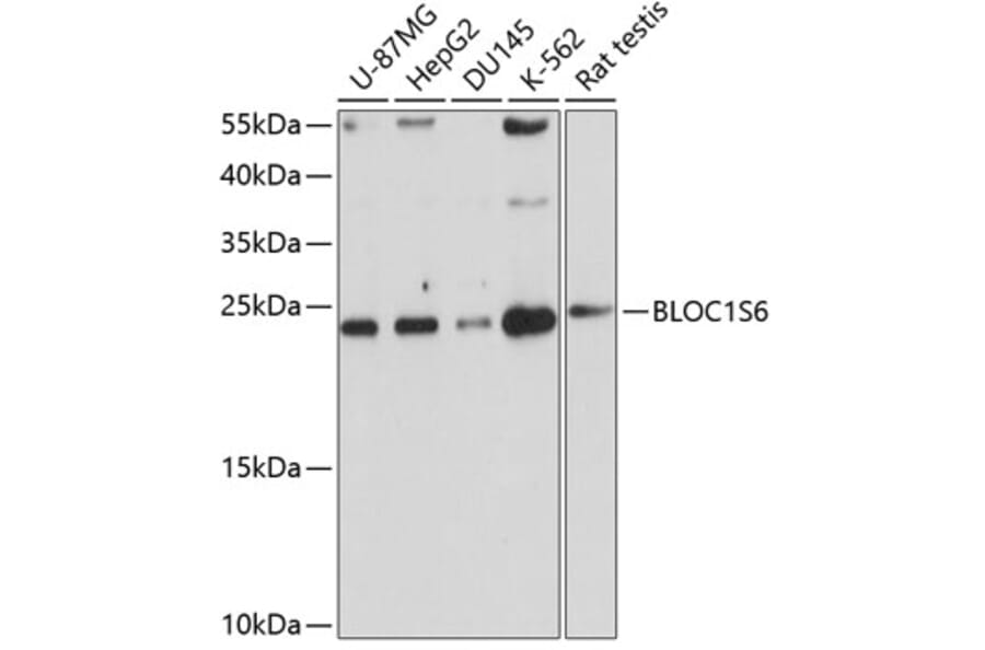 Western Blot - Anti-Pallidin Antibody (A14586) - Antibodies.com