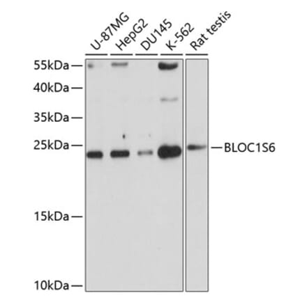 Western Blot - Anti-Pallidin Antibody (A14586) - Antibodies.com