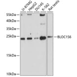 Western Blot - Anti-Pallidin Antibody (A14586) - Antibodies.com