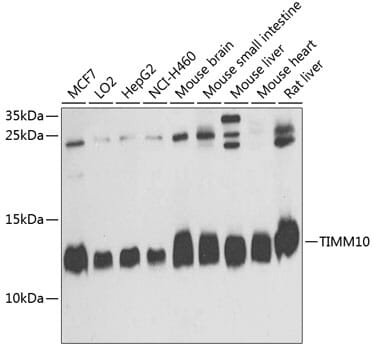 Western blot analysis of extracts of various cell lines, using Anti-TIMM10 Antibody (A4626) at 1:1,000 dilution.
Secondary antibody: Goat Anti-Rabbit IgG (H+L) (HRP) (AS014) at 1:10,000 dilution.
Lysates / proteins: 25µg per lane.
Blocking buffer: 3% non-fat dry milk in TBST.
Detection: ECL Basic Kit (RM00020).
Exposure time: 15s.