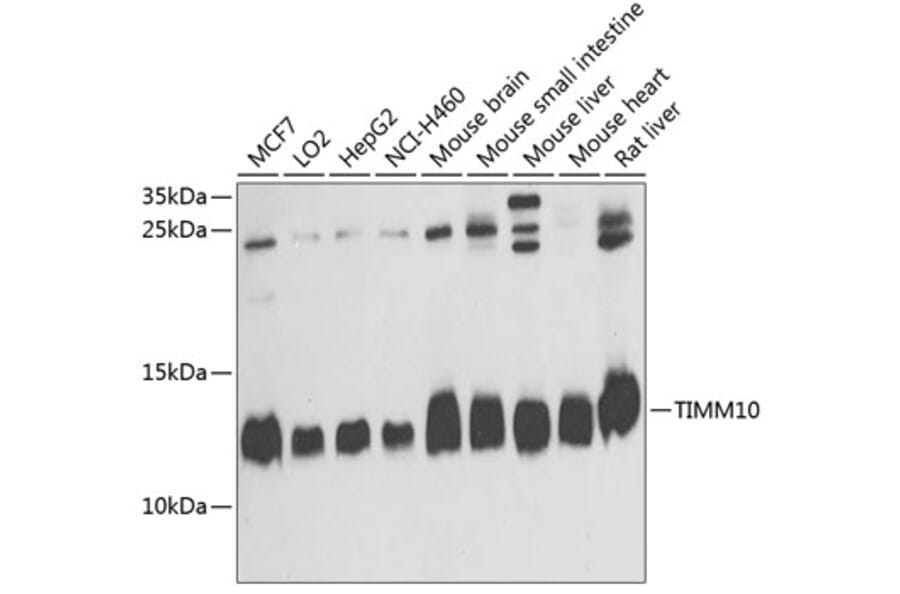 Western Blot - Anti-TIMM10 Antibody (A14587) - Antibodies.com
