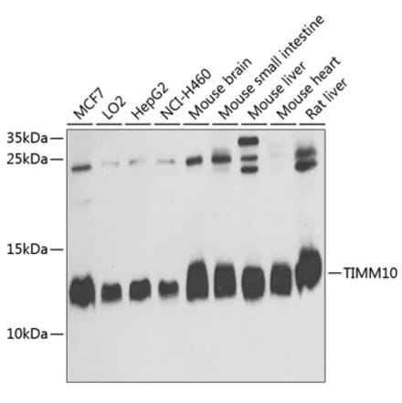 Western Blot - Anti-TIMM10 Antibody (A14587) - Antibodies.com