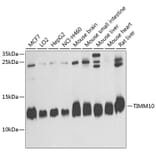 Western Blot - Anti-TIMM10 Antibody (A14587) - Antibodies.com