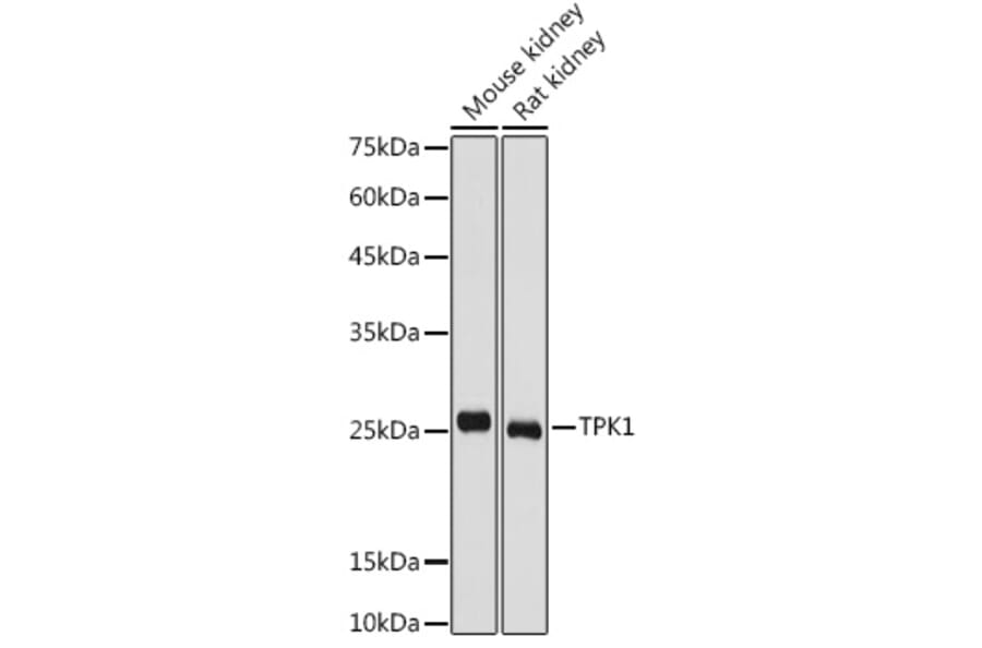Western Blot - Anti-TPK1 Antibody (A14588) - Antibodies.com