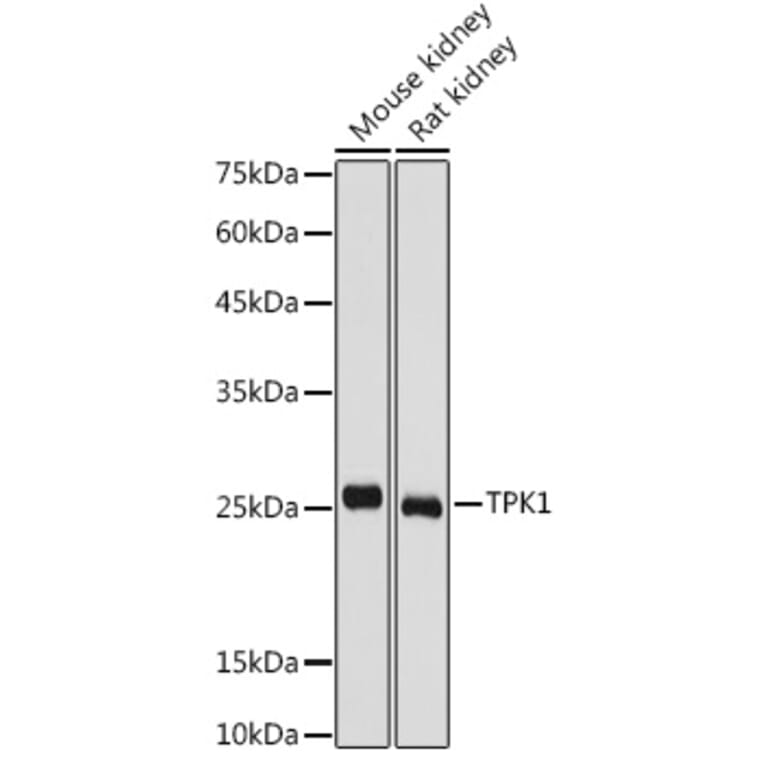 Western Blot - Anti-TPK1 Antibody (A14588) - Antibodies.com