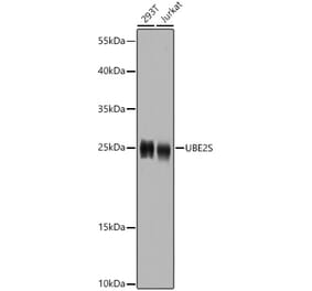 Western Blot - Anti-UBE2S Antibody (A14590) - Antibodies.com