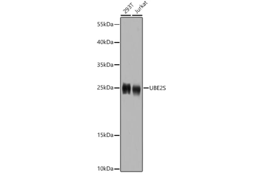Western Blot - Anti-UBE2S Antibody (A14590) - Antibodies.com