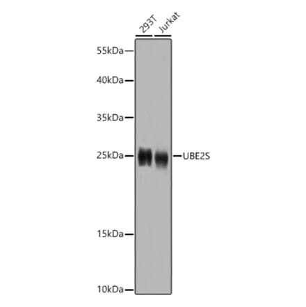 Western Blot - Anti-UBE2S Antibody (A14590) - Antibodies.com