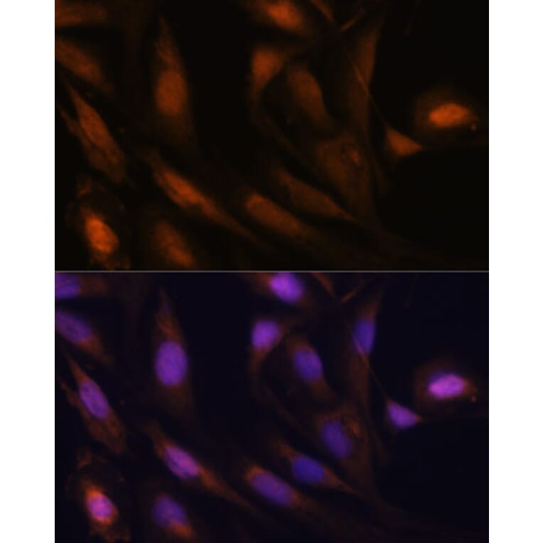 Immunofluorescence - Anti-UBE2S Antibody (A14590) - Antibodies.com