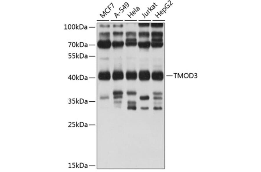 Western Blot - Anti-Tropomodulin 3 Antibody (A14591) - Antibodies.com