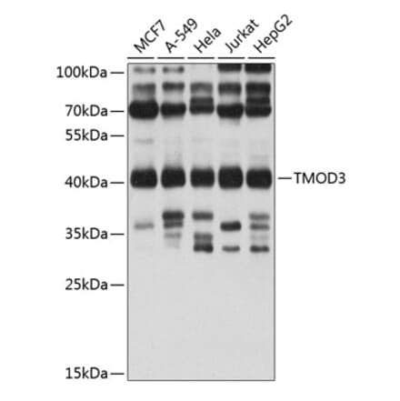 Western Blot - Anti-Tropomodulin 3 Antibody (A14591) - Antibodies.com