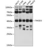 Western Blot - Anti-Tropomodulin 3 Antibody (A14591) - Antibodies.com