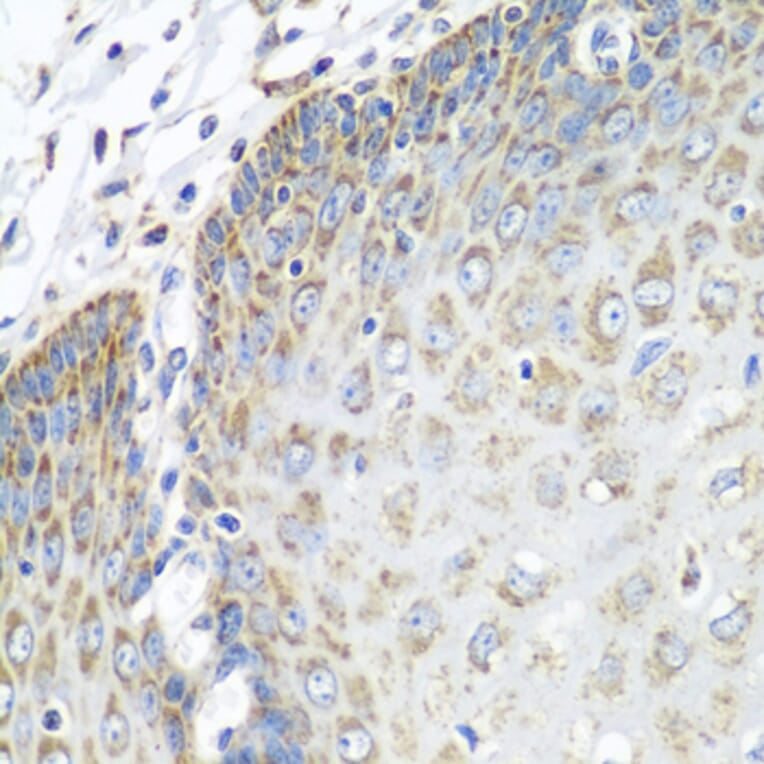 Immunohistochemistry - Anti-Tropomodulin 3 Antibody (A14591) - Antibodies.com