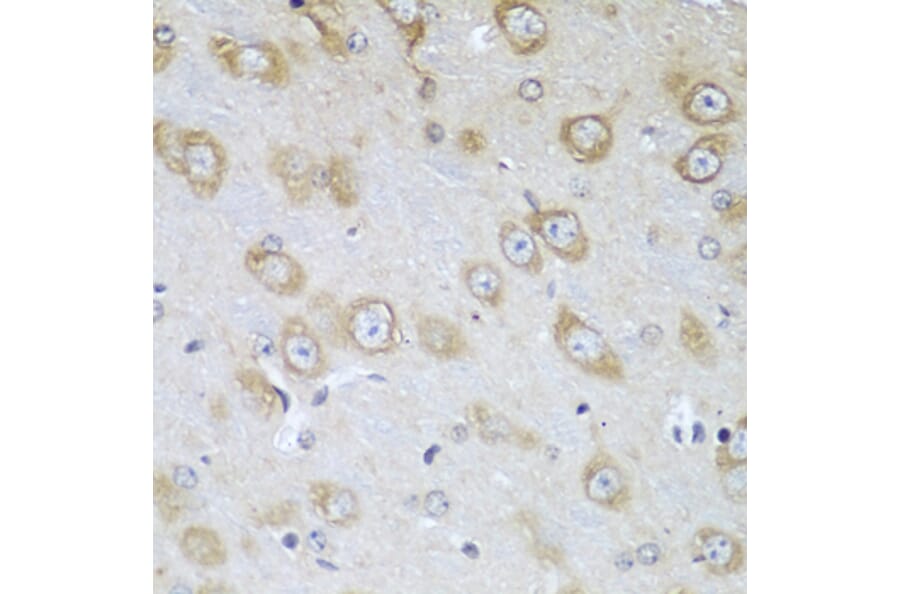 Immunohistochemistry - Anti-Tropomodulin 3 Antibody (A14591) - Antibodies.com