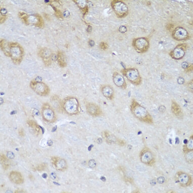 Immunohistochemistry - Anti-Tropomodulin 3 Antibody (A14591) - Antibodies.com