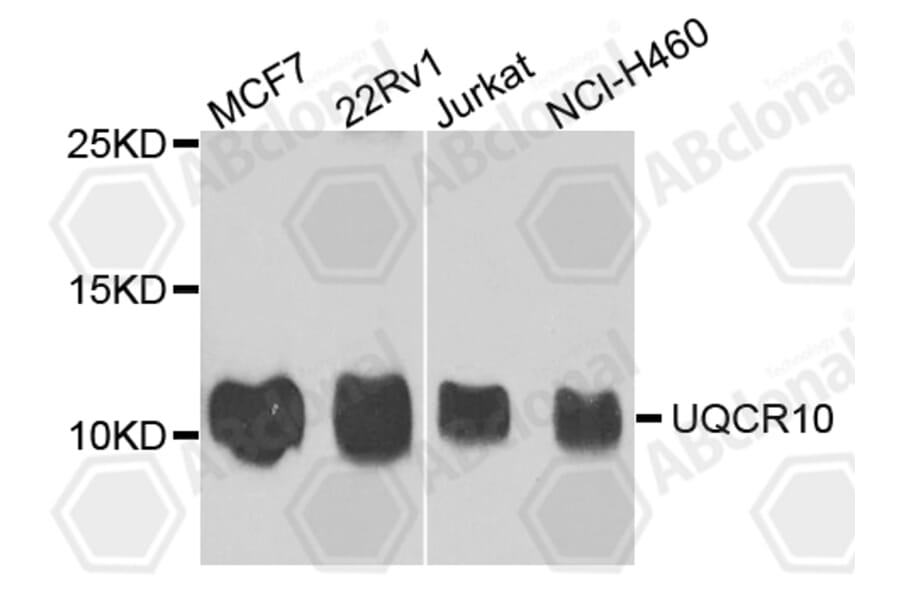 Western Blot - Anti-UQCR10 Antibody (A4674) - Antibodies.com