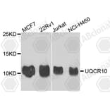 Western Blot - Anti-UQCR10 Antibody (A4674) - Antibodies.com