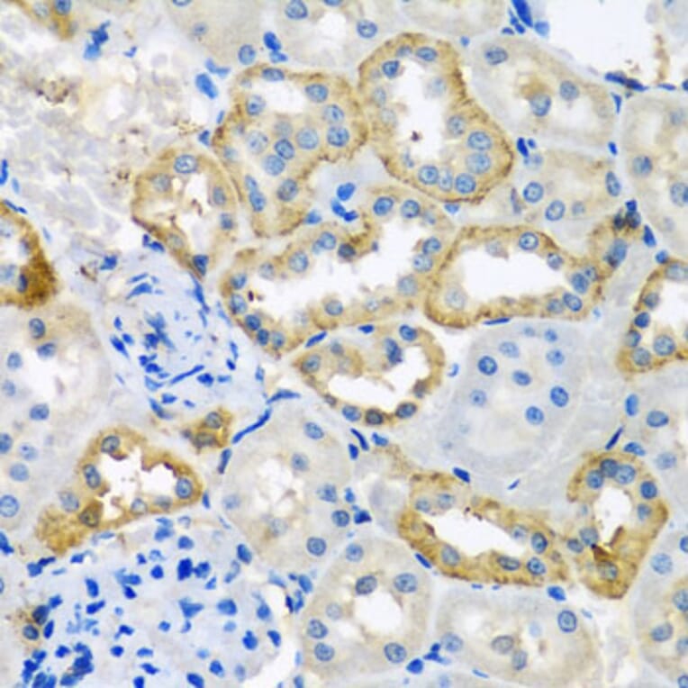 Immunohistochemistry - Anti-UQCR10 Antibody (A4674) - Antibodies.com