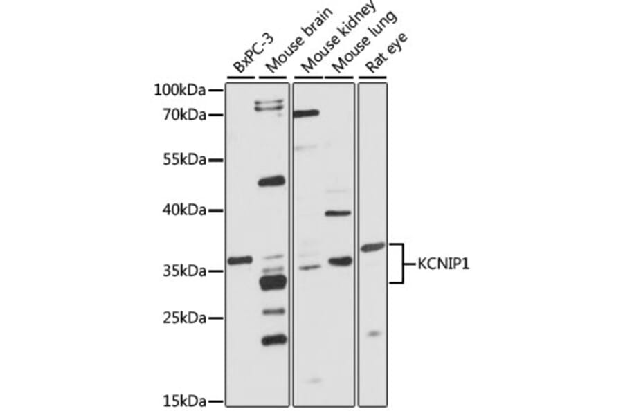 Western Blot - Anti-KCNIP1 Antibody (A4684) - Antibodies.com