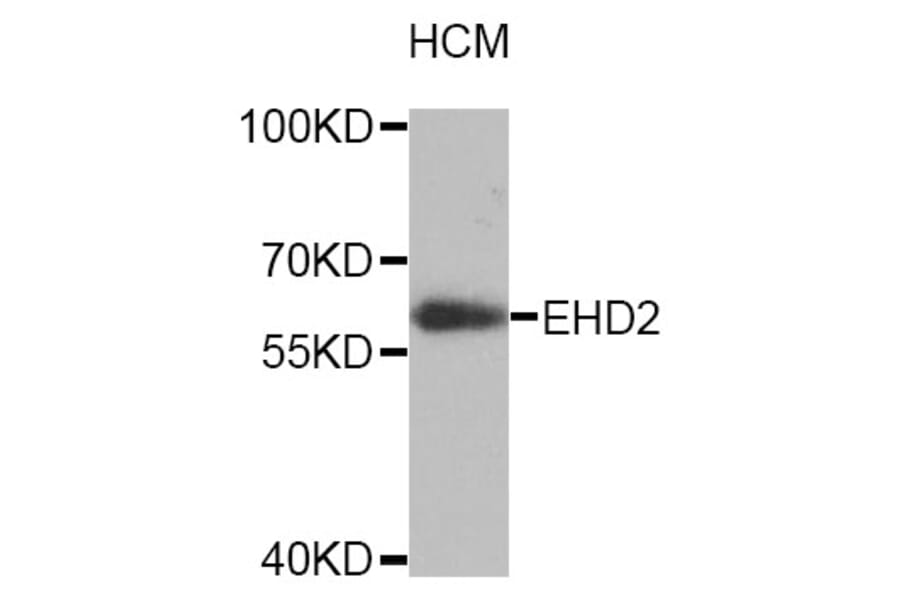 Western Blot - Anti-EHD2 Antibody (A4685) - Antibodies.com
