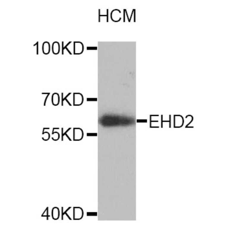 Western Blot - Anti-EHD2 Antibody (A4685) - Antibodies.com