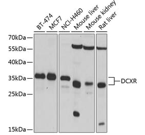 Western Blot - Anti-DCXR Antibody (A14595) - Antibodies.com
