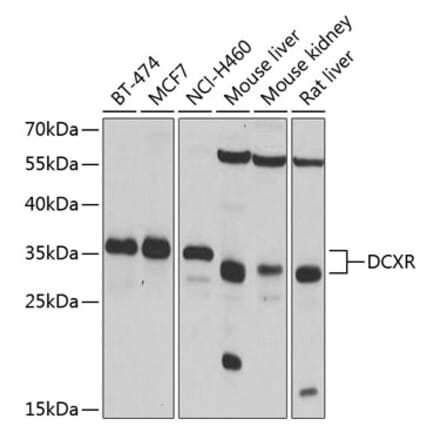 Western Blot - Anti-DCXR Antibody (A14595) - Antibodies.com