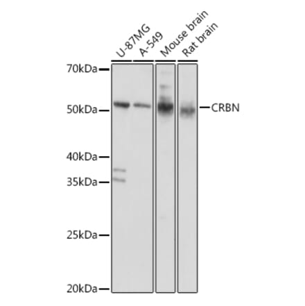 Western Blot - Anti-CRBN Antibody (A14596) - Antibodies.com