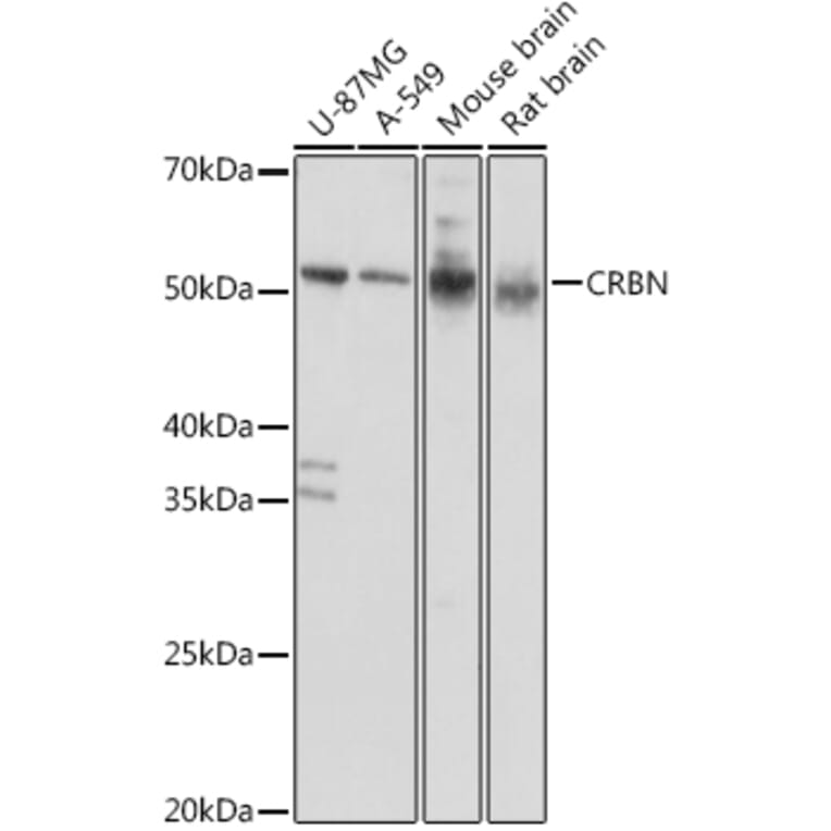 Western Blot - Anti-CRBN Antibody (A14596) - Antibodies.com