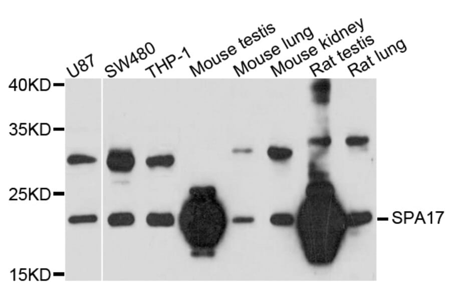 Western Blot - Anti-SPA17 Antibody (A4769) - Antibodies.com