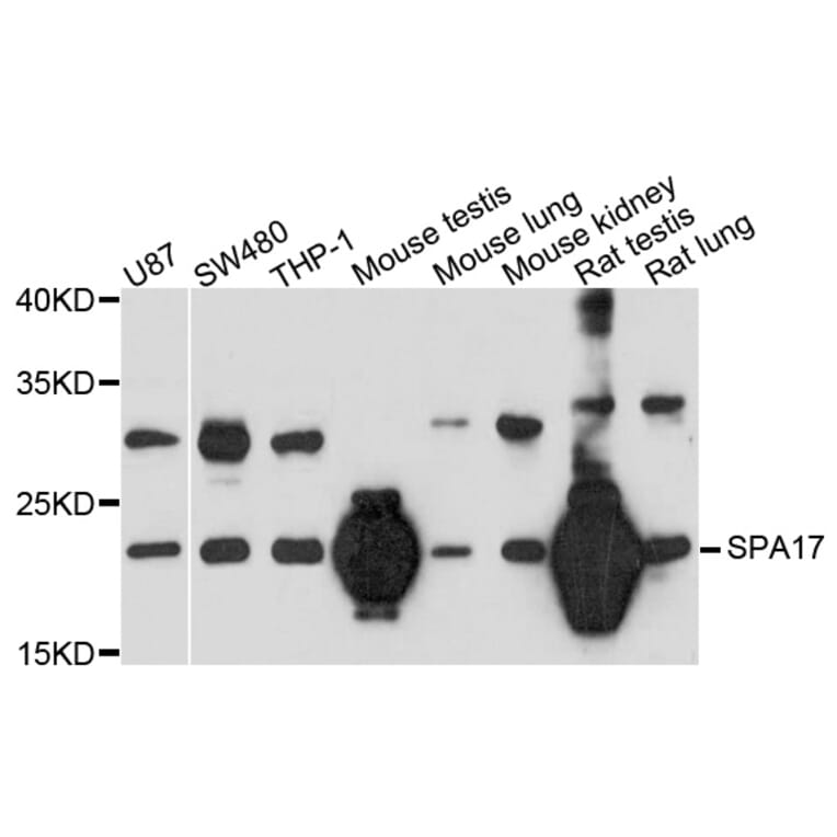 Western Blot - Anti-SPA17 Antibody (A4769) - Antibodies.com