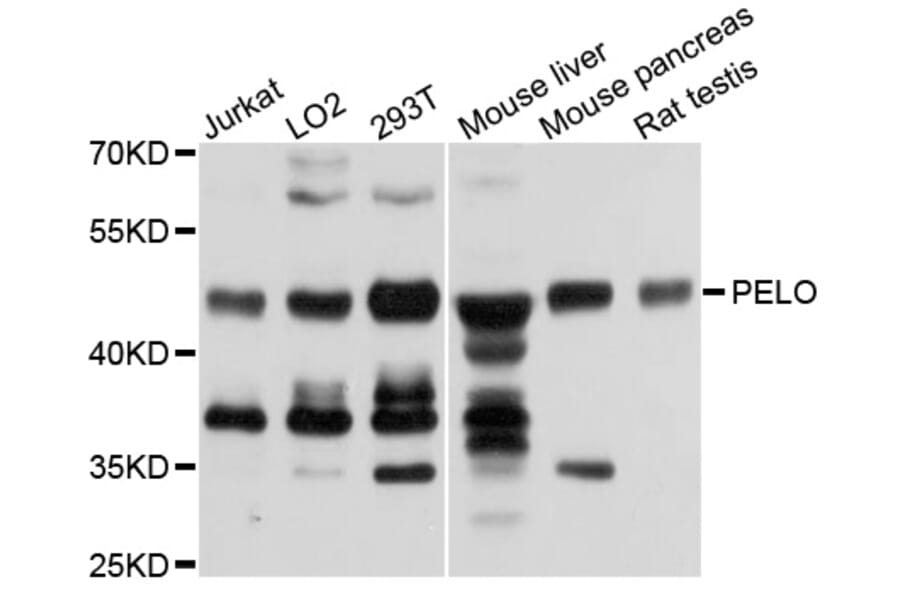 Western Blot - Anti-PELO Antibody (A4776) - Antibodies.com