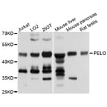 Western Blot - Anti-PELO Antibody (A4776) - Antibodies.com