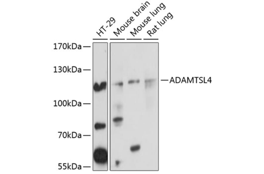 Western Blot - Anti-ADAMTSL4 Antibody (A14601) - Antibodies.com