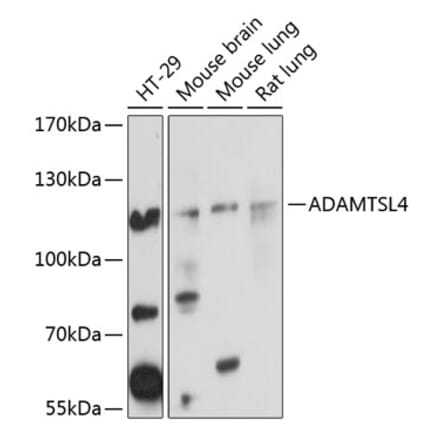 Western Blot - Anti-ADAMTSL4 Antibody (A14601) - Antibodies.com
